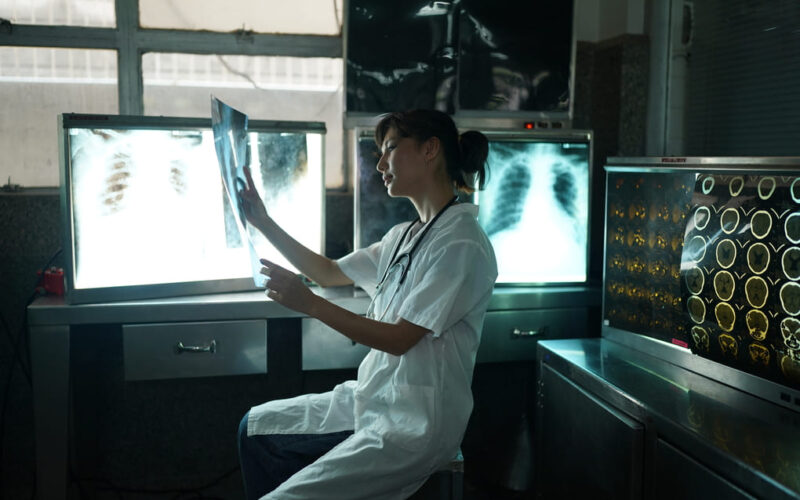 Distrofia muscular de Duchenne: tratamientos en Guatemala