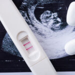 Clomifeno y fertilización in vitro: guía para personas de Colombia